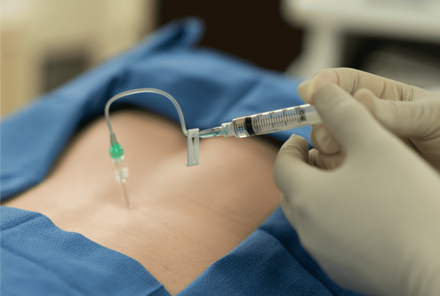 Lumbar Epidural Steroid Injection