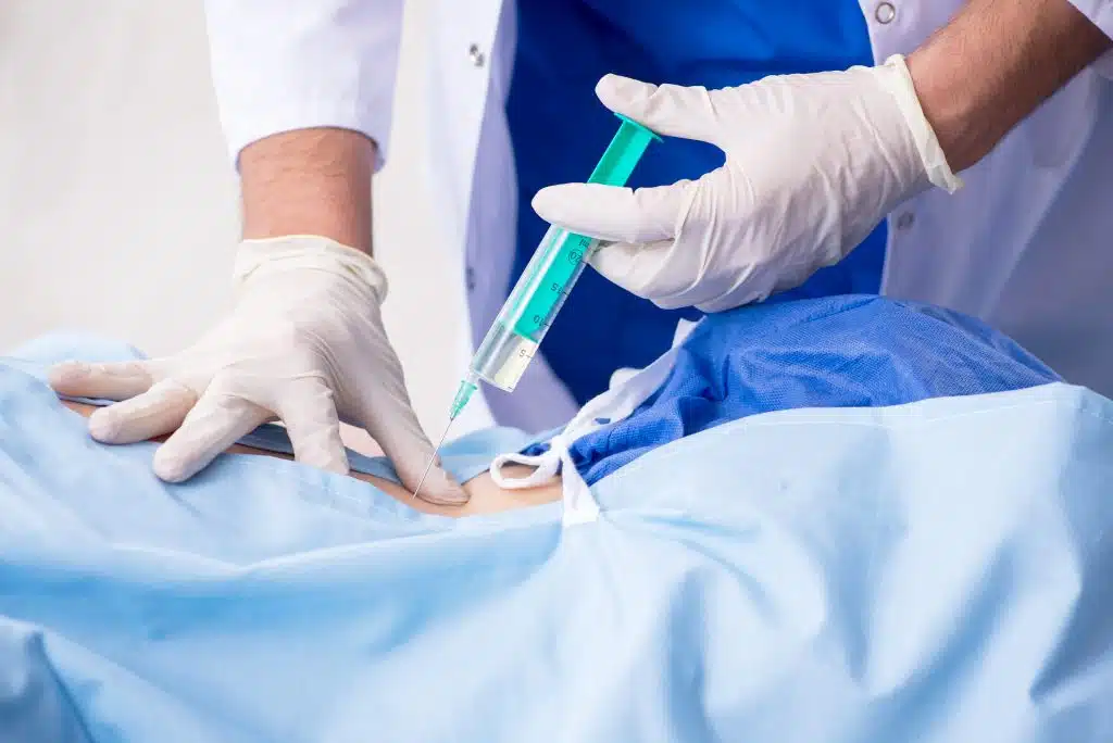 Thoracic Transforaminal Epidural Steroid Injection